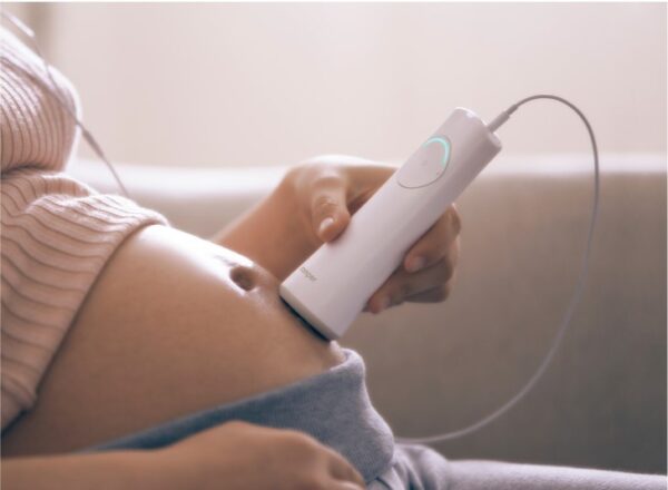 Fetal Heart Rate Monitor - Image 2